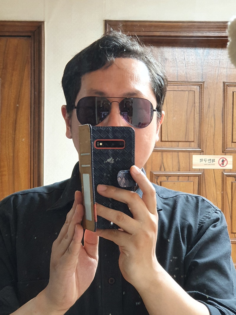JP성형외과_모발이식_2020_06_04_004.jpg