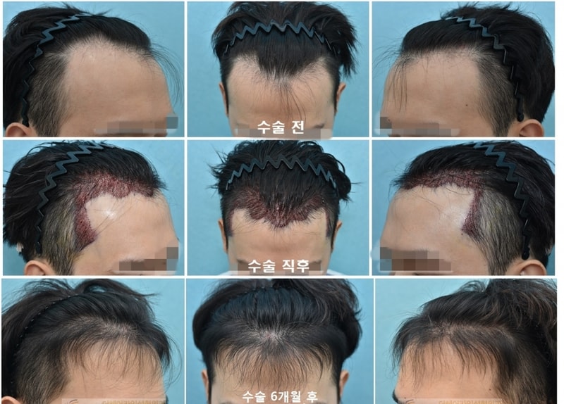 6개월 수정.jpg
