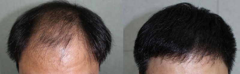 1년 1.jpg