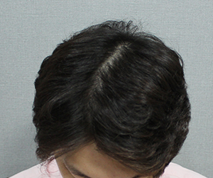 김성현님 경과 2.jpg