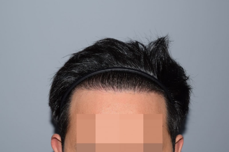 q.JPG