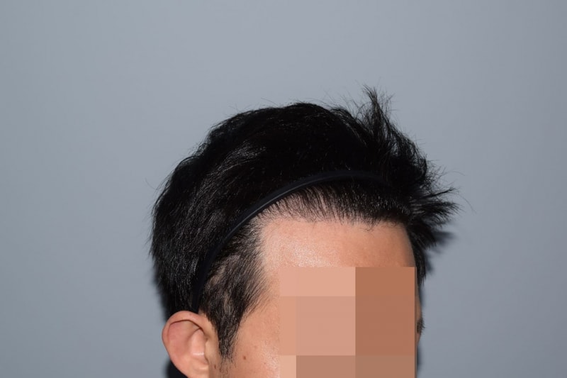 e.JPG