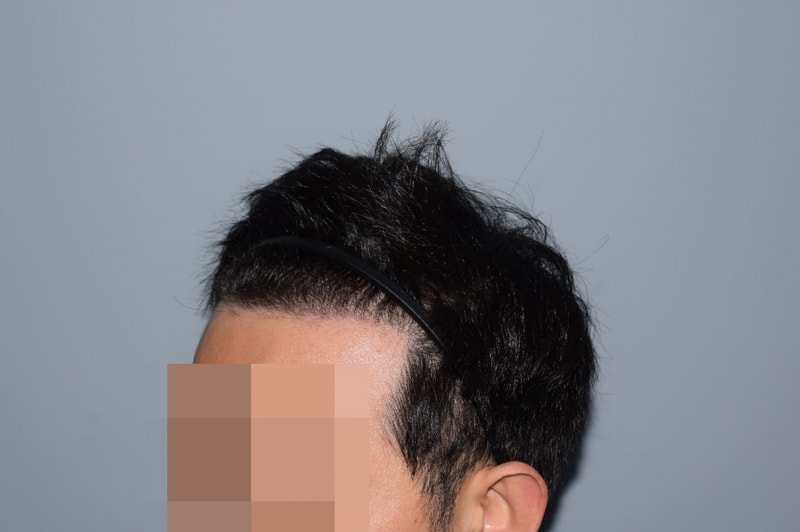 w.JPG