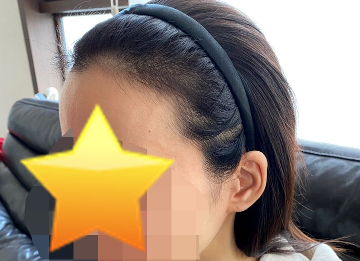 수술전 입니다.jpg