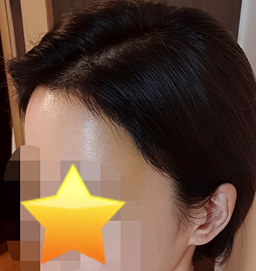 수술후.jpg