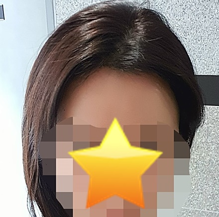 수술후최근.jpg