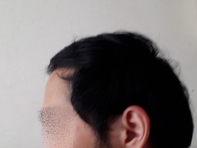 왼.jpg