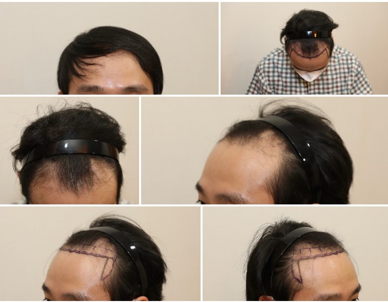 제목 없음.jpg
