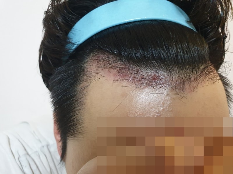 모자이크_왼.jpg