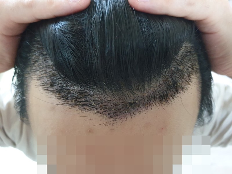 모자이크_정.jpg