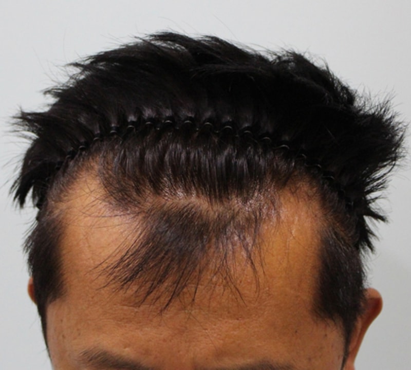수술전1.jpg