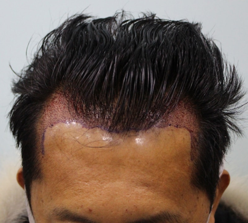 수술후1.jpg