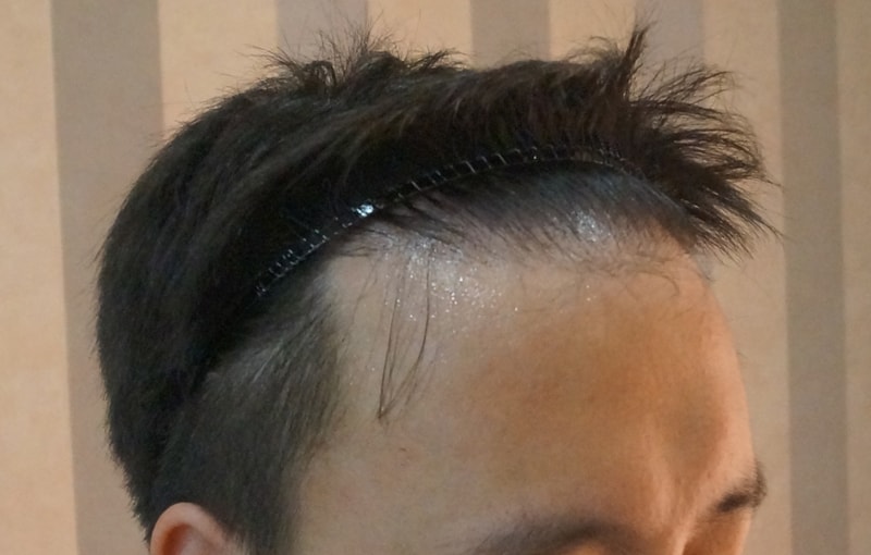 수술직전2.jpg