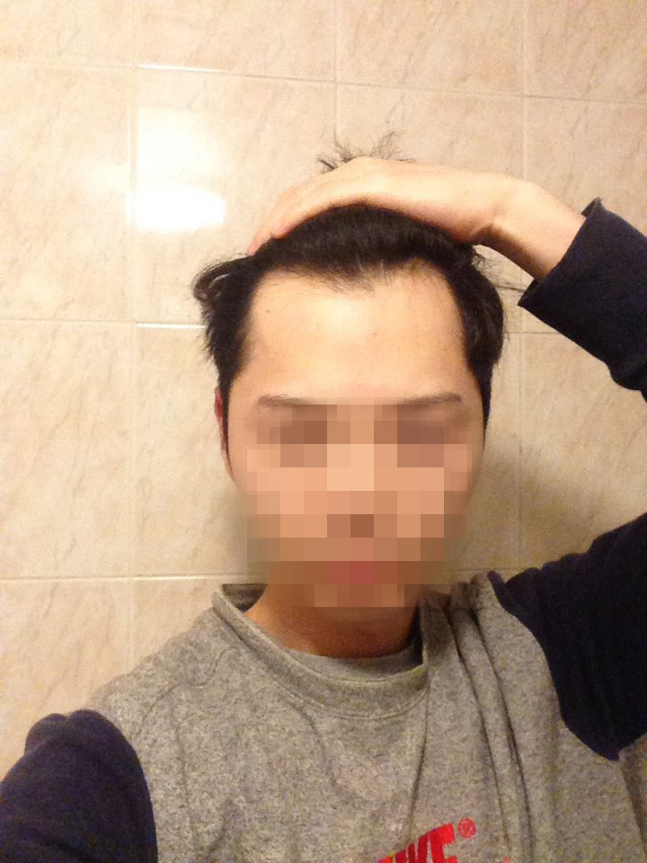 01.노민준 수술전.jpeg