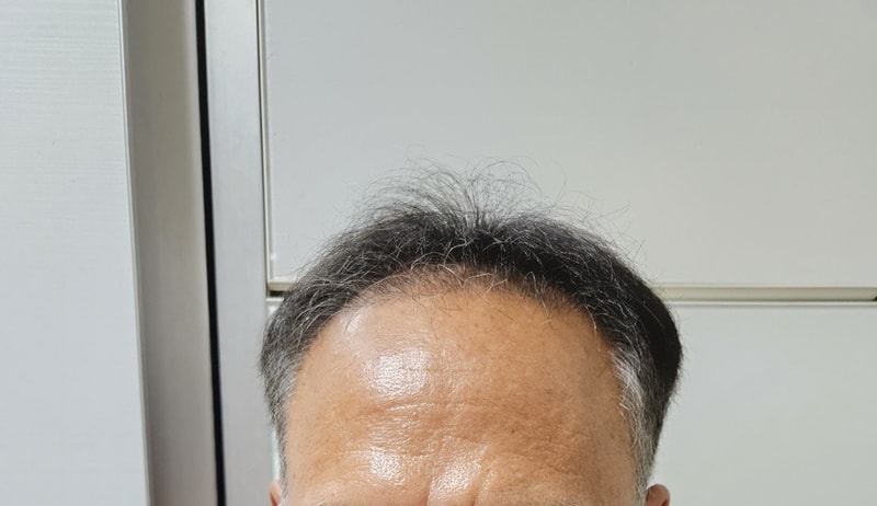 g.jpg