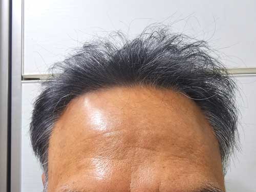 나의이마 3.jpg