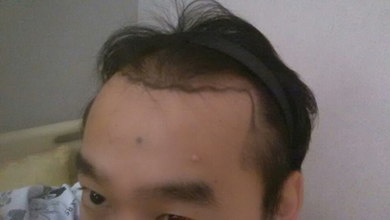 1)수술당일 (5).jpg