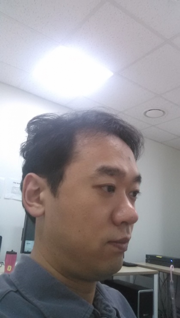4)수술후 7개월 (5).jpg