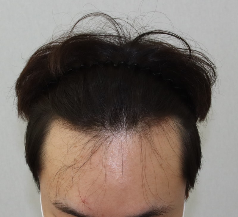 전 3.JPG