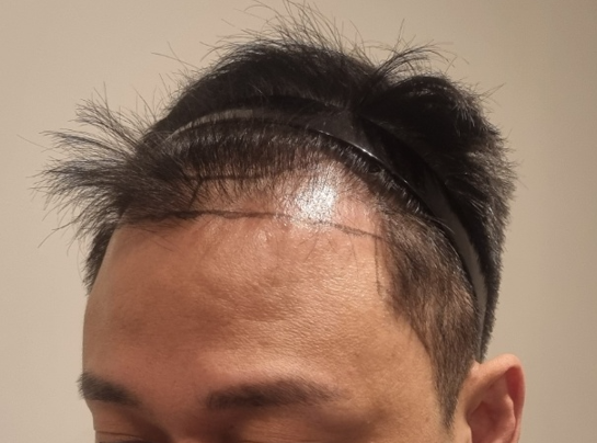 2.png