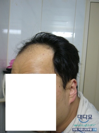 2009년1차수술전_2.jpg