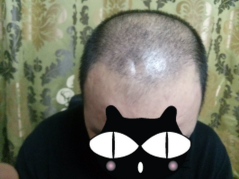 위.png