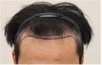 수술디자인.jpg