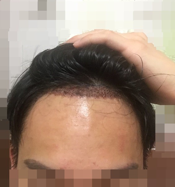 3개월이 지났습니다