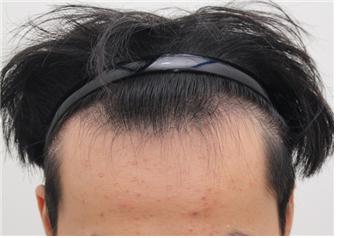 수술전.jpg