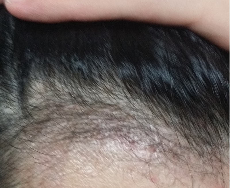 대략 3개월 후기..