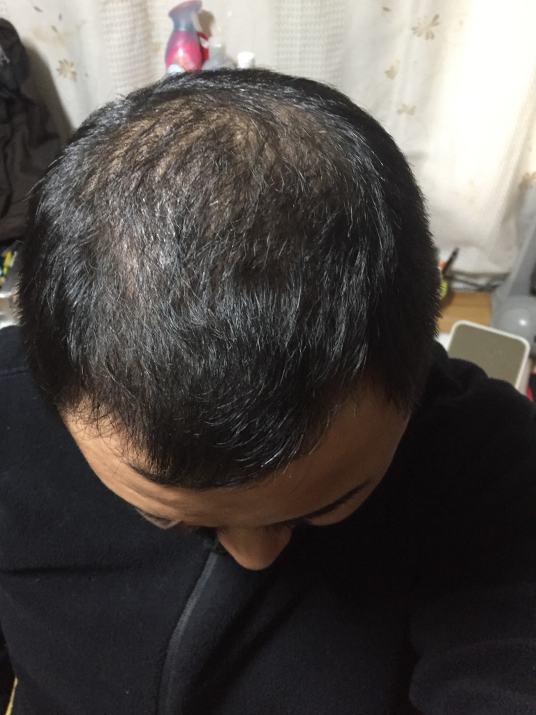 KakaoTalk_20180227_151806090.jpg