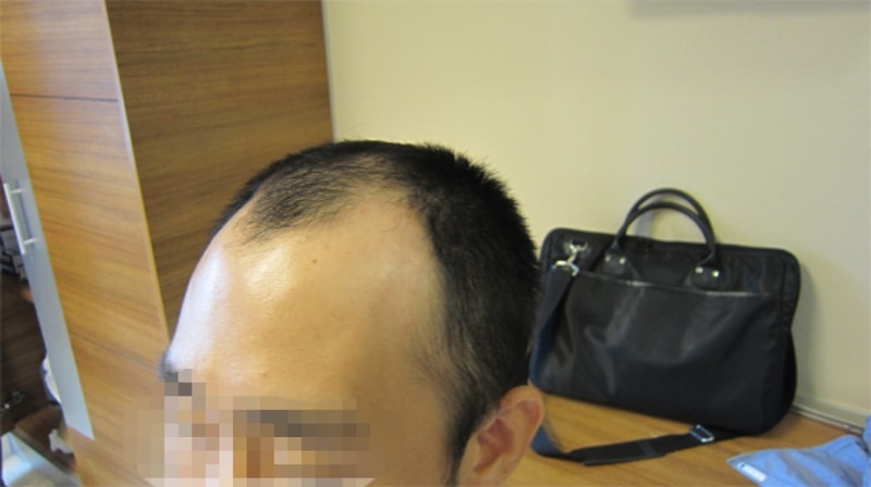 수술전.jpg
