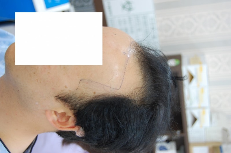 좌측사진-1.JPG
