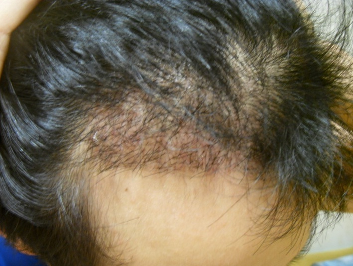 15일째2.jpg