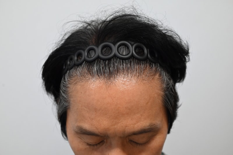 2.수술전.jpg