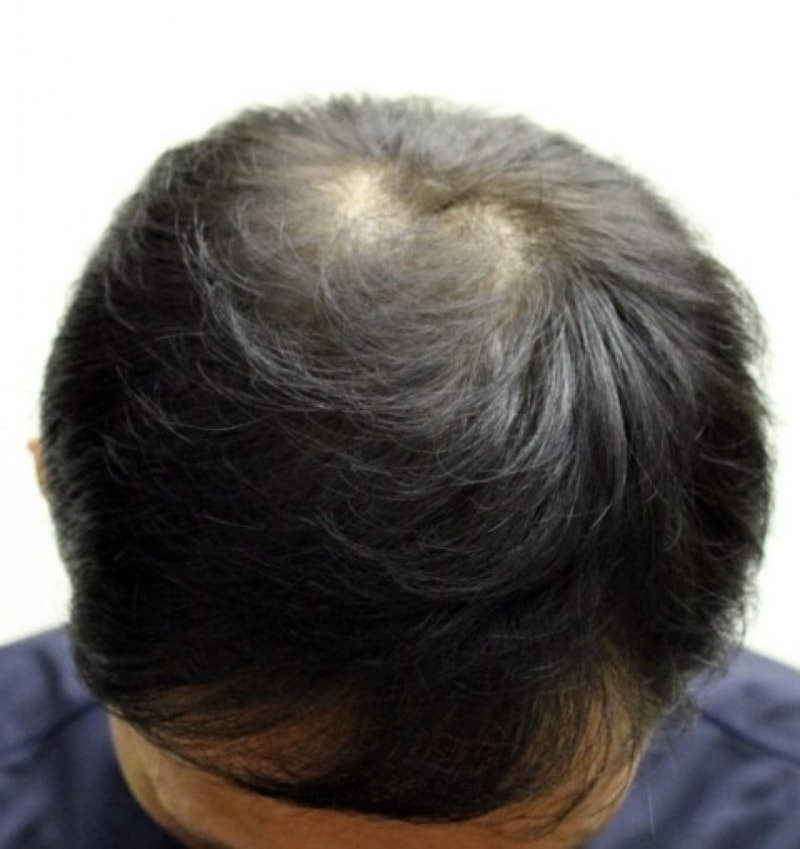1년 1.jpg