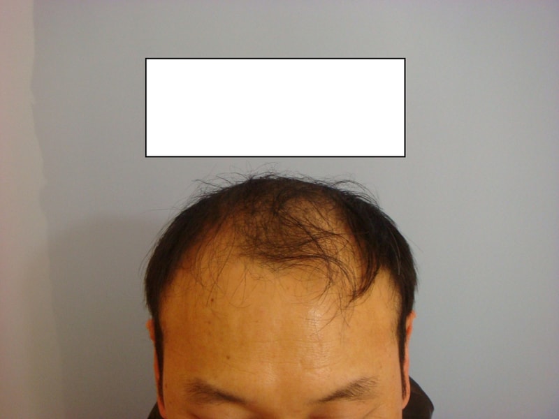 이식전20.jpg