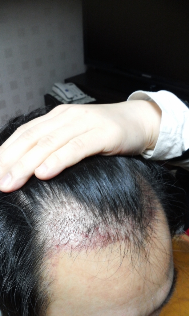 20160123_0655484.jpg