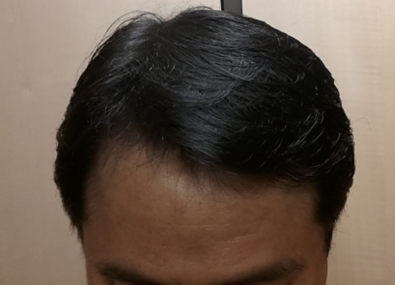 150424 106일 경과2.jpg