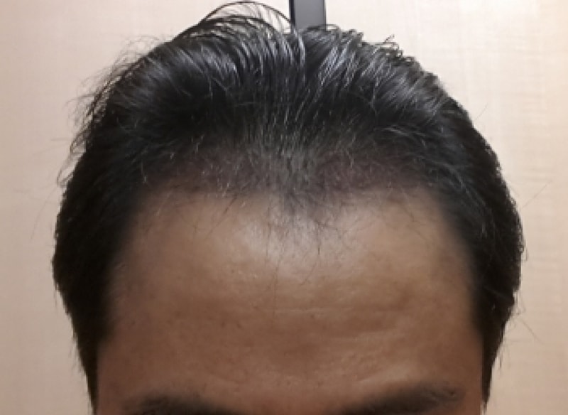 150424 106일 경과.jpg