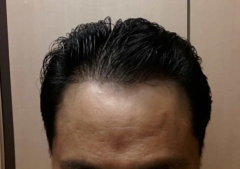 150709 181일경과.jpg