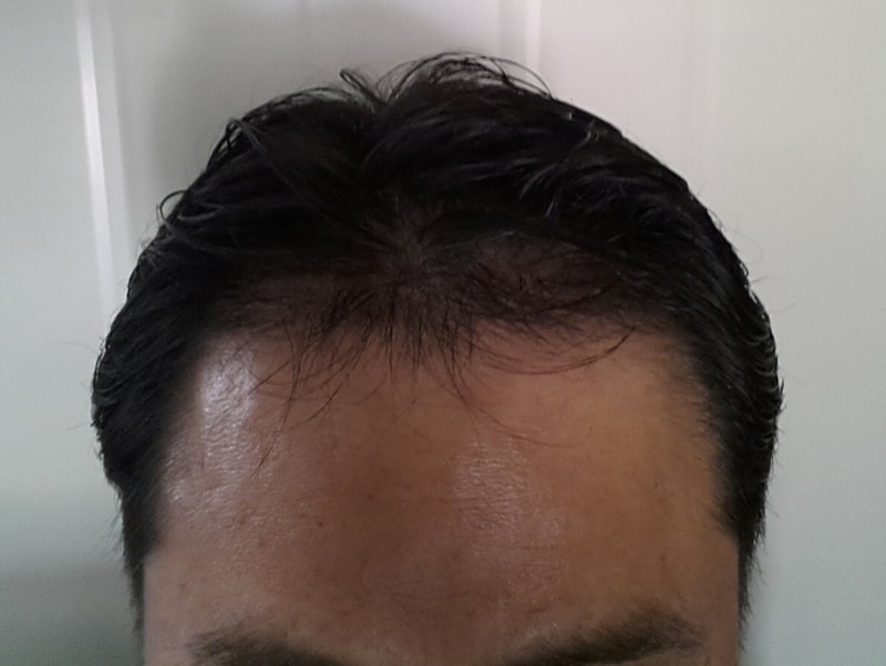 50612 154일경과.jpg