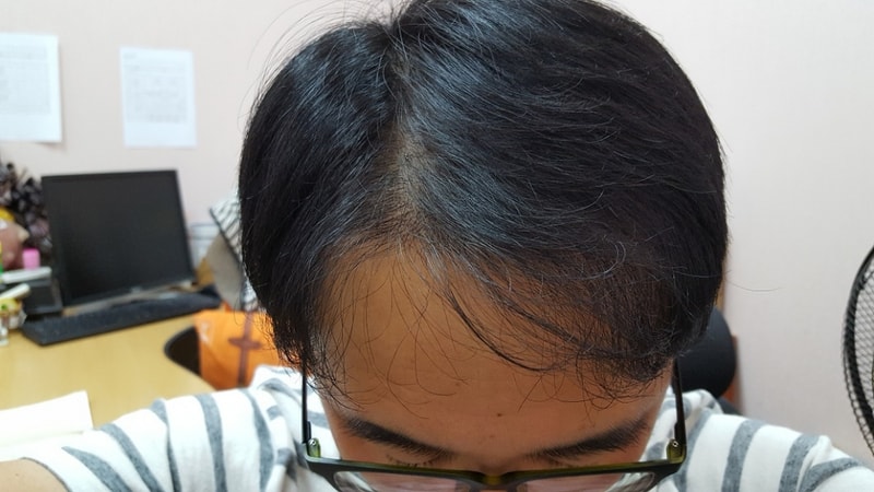 1년후6.jpg