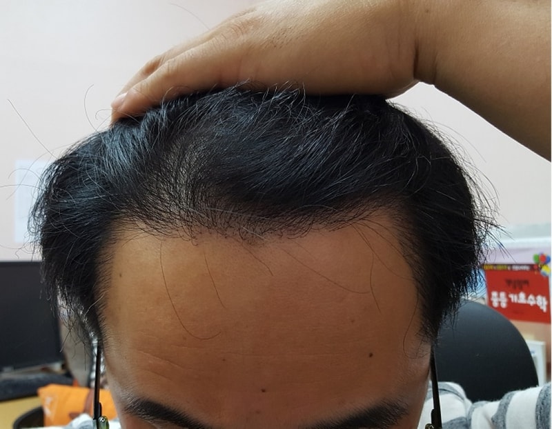 1년후3.jpg