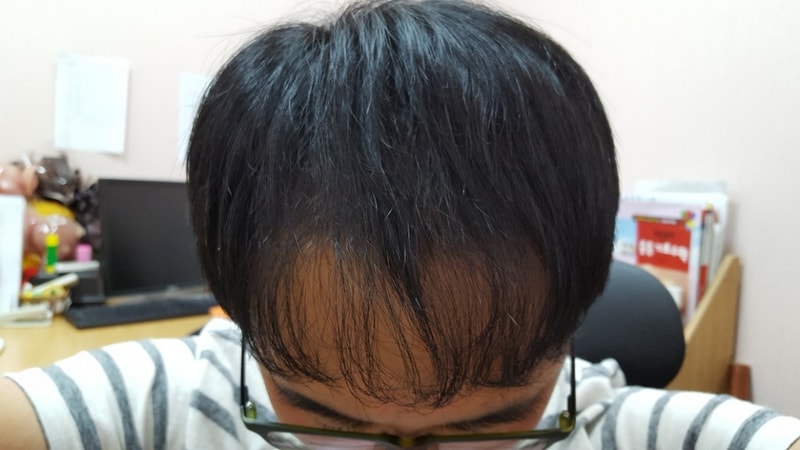 1년후5.jpg