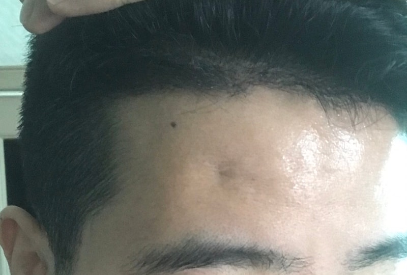 오른쪽.jpg