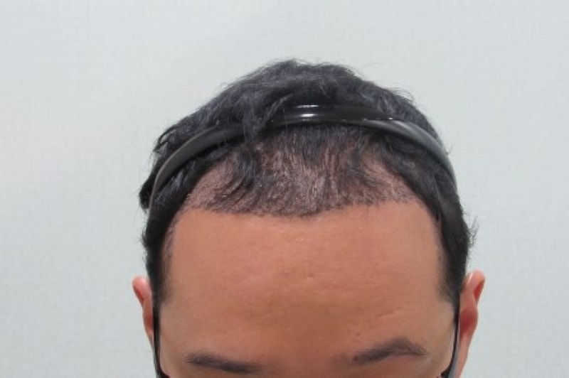 정면 후.jpg
