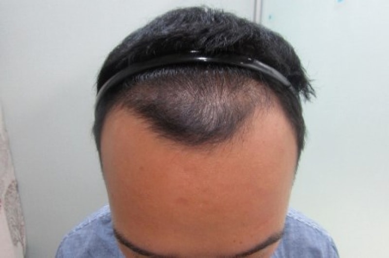 정면 전.jpg