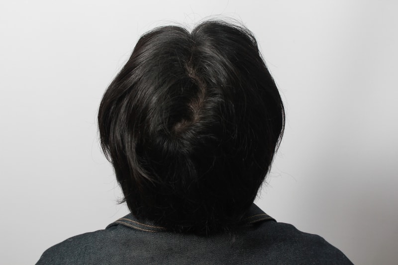뒷통수.JPG