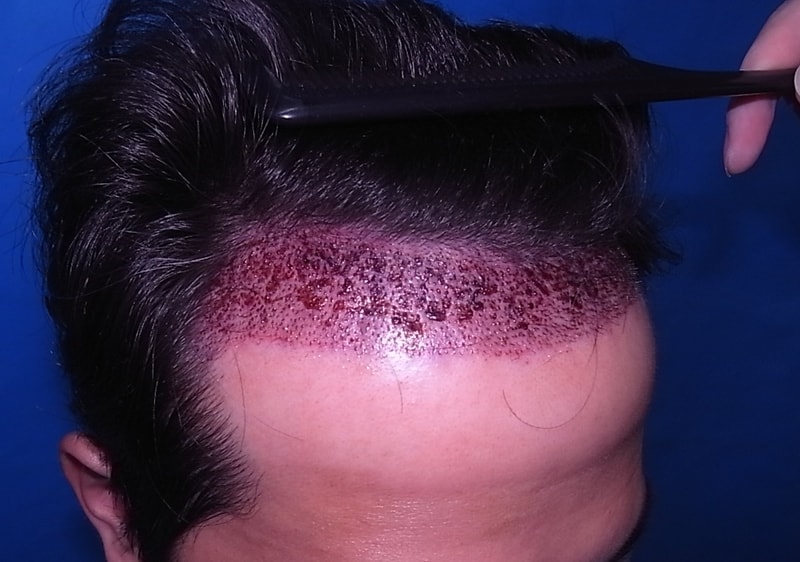 일괄편집_R0078100.jpg